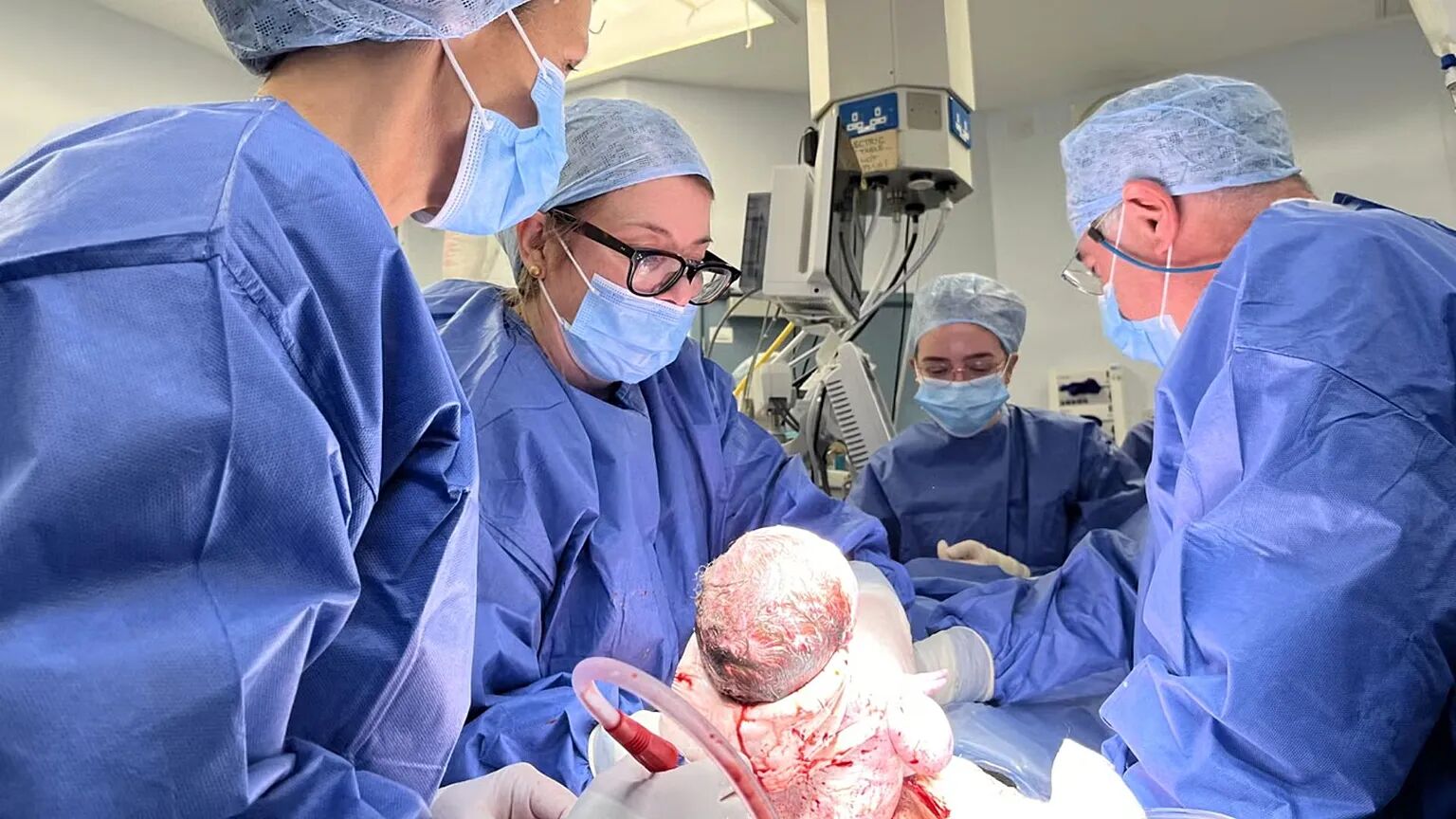 Miracle Baby Born After Historic Womb Transplant