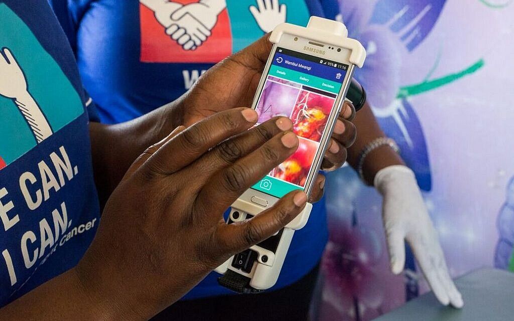 Beyond the Pap smear: Startup uses phone, light and AI to detect cervical cancer