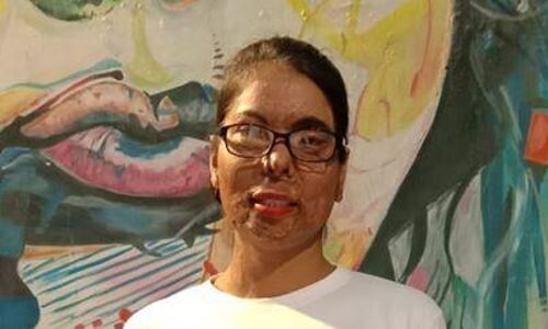 I was a bird. My wings are broken now. says acid attack survivor