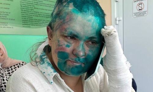 Investigation Into Attack of Award-Winning Journalist: Rights Groups, Russian President Voice Concern