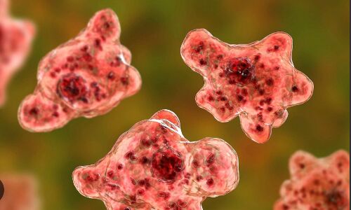 Georgia Resident Dies From Rare Brain-Eating Amoeba Infection: 6th Case Reported Since 1962 Georgia Resident Dies From Rare Brain-Eating Amoeba Infection: 6th Case Reported Since 1962