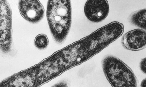 Chlorine Disinfection Curbs Legionnaires Disease Outbreak in Southeast Poland, Only One New Case Reported Chlorine Disinfection Curbs Legionnaires Disease Outbreak in Southeast Poland, Only One New Case Reported