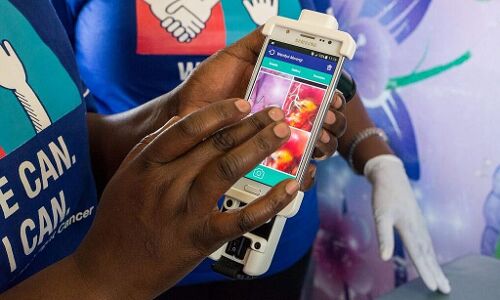 Beyond the Pap smear: Startup uses phone, light and AI to detect cervical cancer