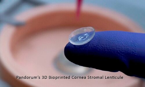 Bengaluru Startup Pandorum Bio-Engineers Cornea Tissue for Scar-Less Regeneration & Vision Restoration Bengaluru Startup Pandorum Bio-Engineers Cornea Tissue for Scar-Less Regeneration & Vision Restoration