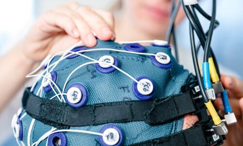 Top 5 Companies Who Are Pushing The Frontiers Of AGI With Neuroscience