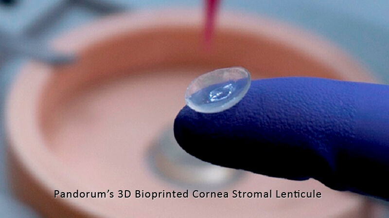 Bengaluru Startup Pandorum Bio-Engineers Cornea Tissue for Scar-Less Regeneration & Vision Restoration