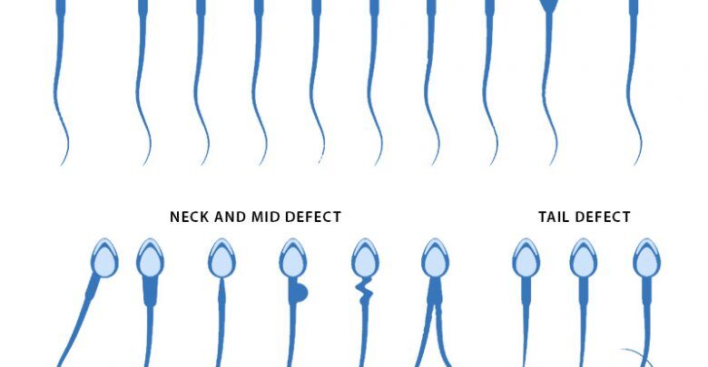 Global Semen Analysis Market – Global Industry Insights, Trends, Analysis and Forecast 2018-2025 - Market Journal
